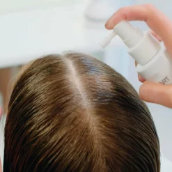 Anti Hair Loss Direct Spray