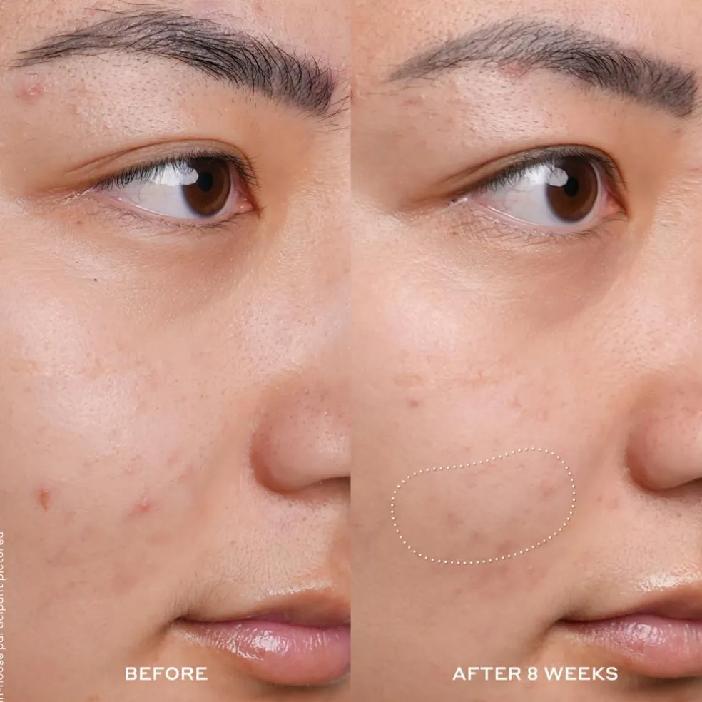 Banana Bright Vitamin C Serum