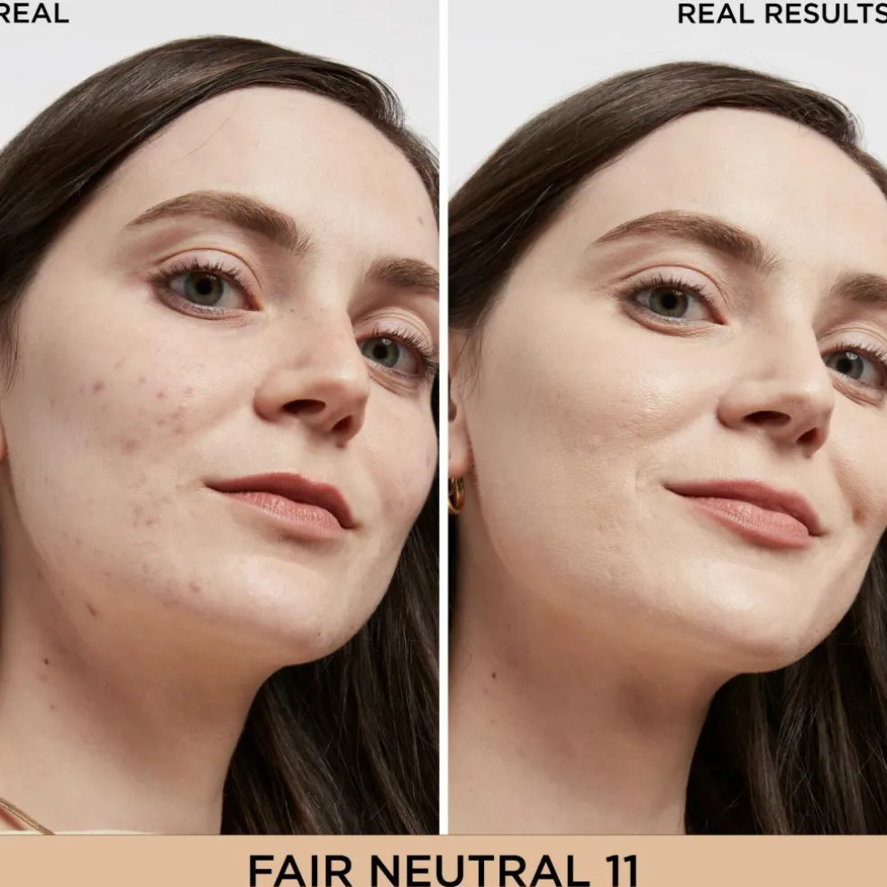 Bye Bye Dark Spots Concealer + Serum