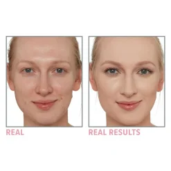Bye Bye Pores Pressed