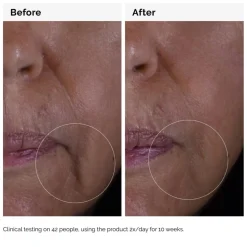 GF 15% Solution Serum