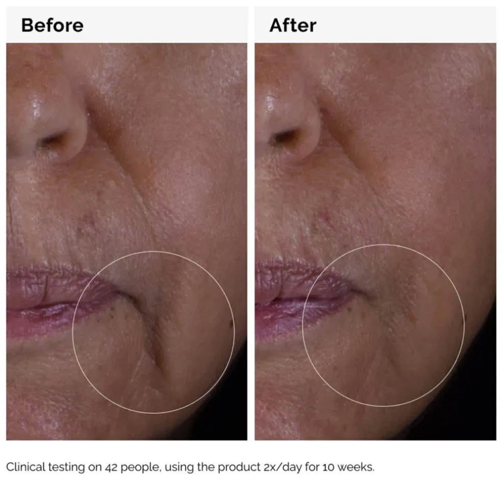 GF 15% Solution Serum