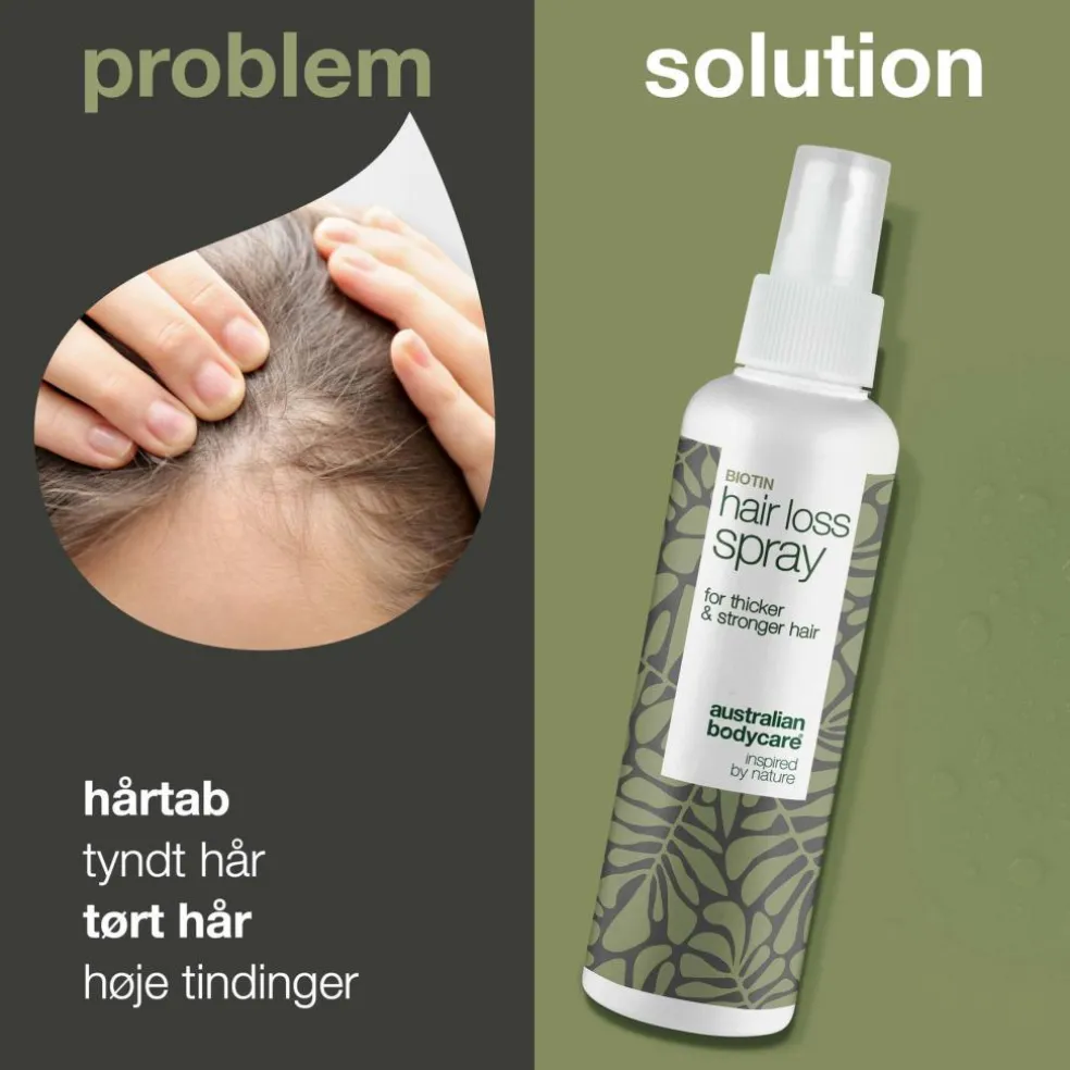 Hair Loss Spray