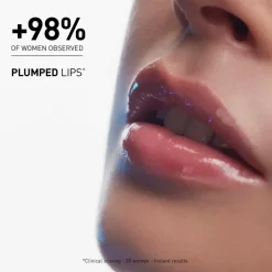 Hyalu-Filler Lips