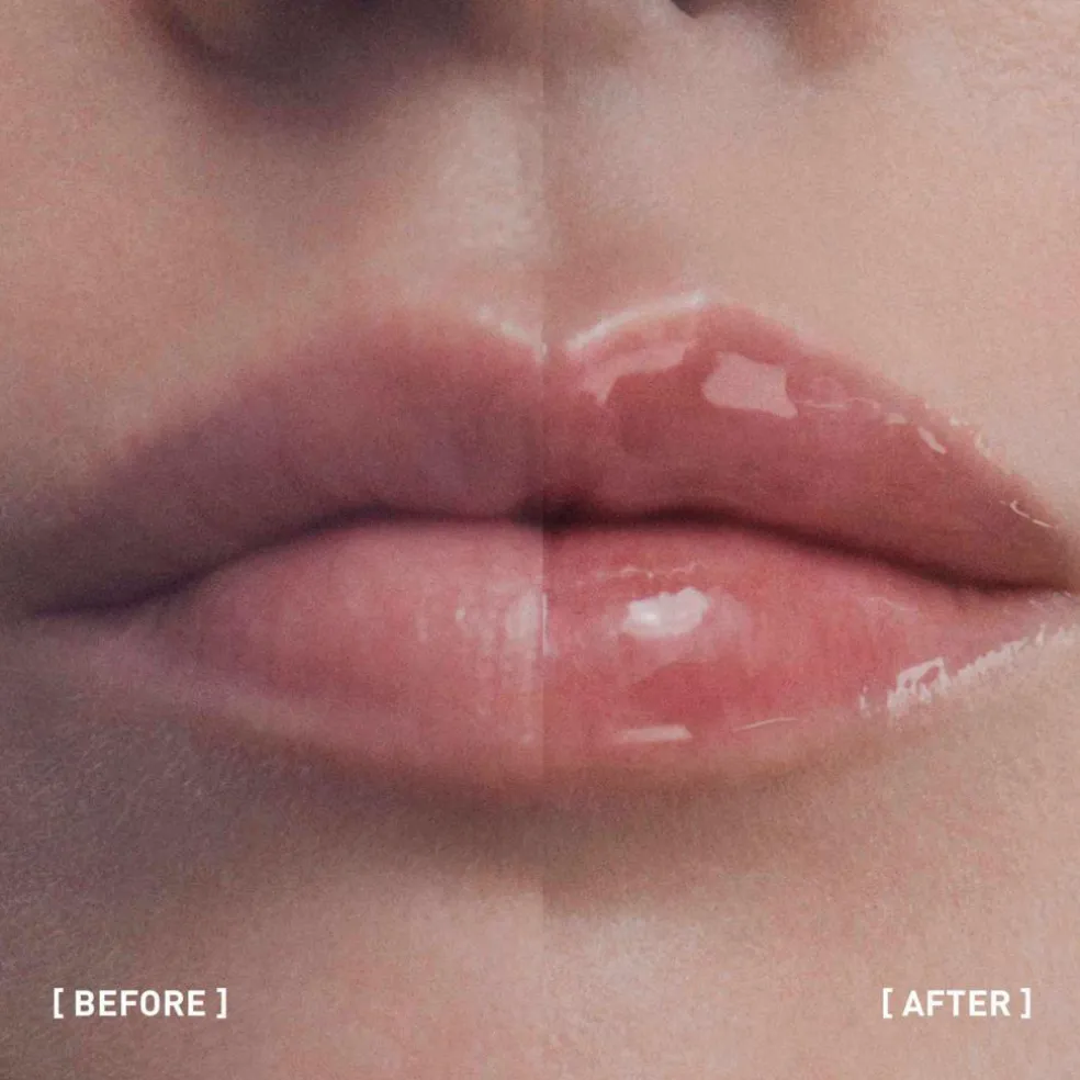 Hyalu-Filler Lips