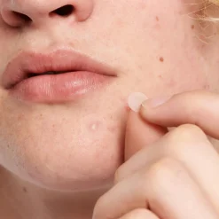 Invisible Pimple Patches
