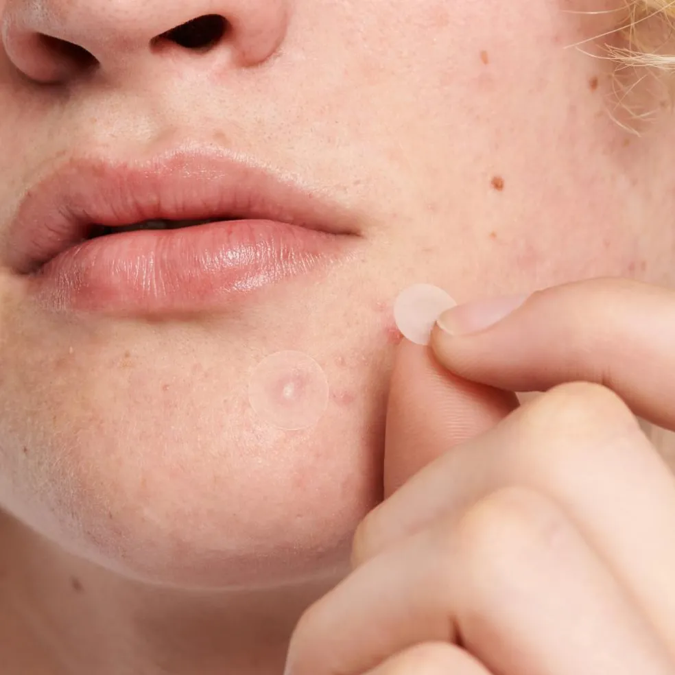 Invisible Pimple Patches