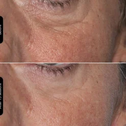 LED Face Mask 100