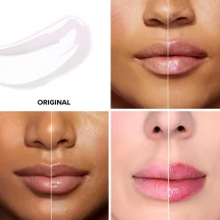 Lip Injection Maximum Dose