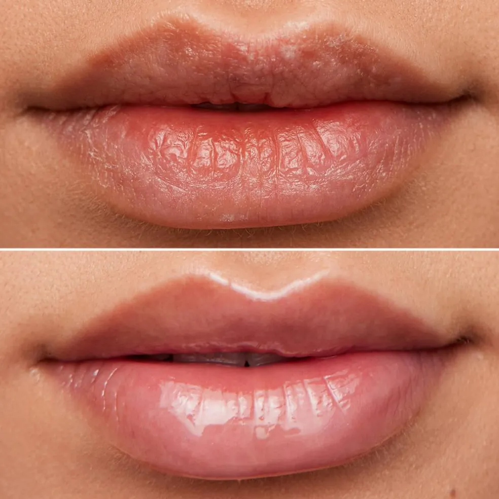 Lip Rehab Serum Oil