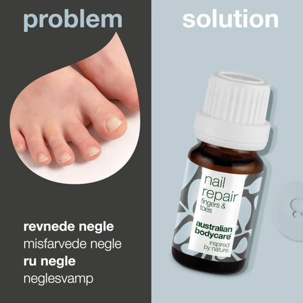 Nail Repair