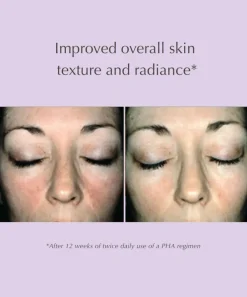 Overnight Transformation Complex