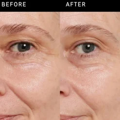 Retinol Eye Cream