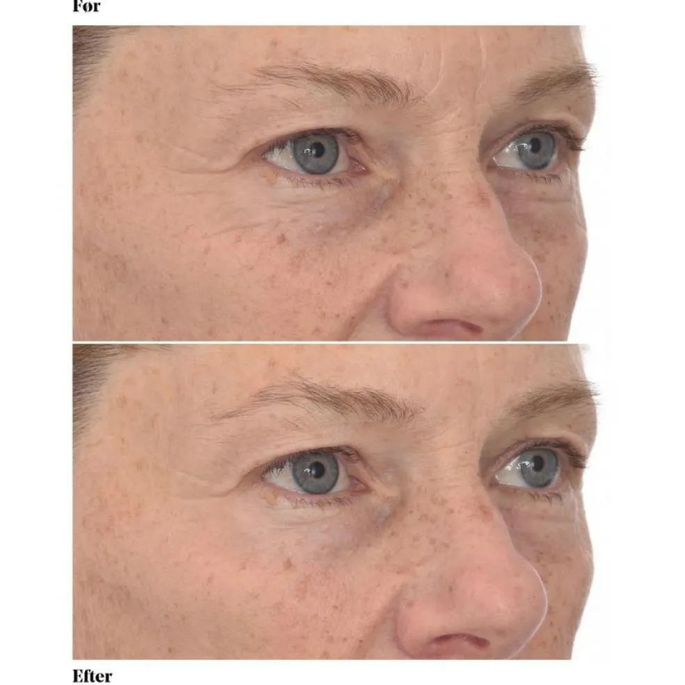 Retinol Youth Renewal Eye Masks