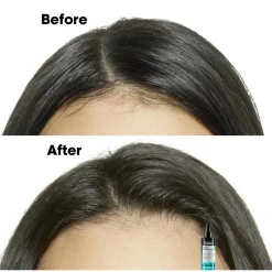 Scalp Advanced Anti-Discomfort Shampoo