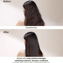 Scalp Solutions Stimulating Scalp Massager