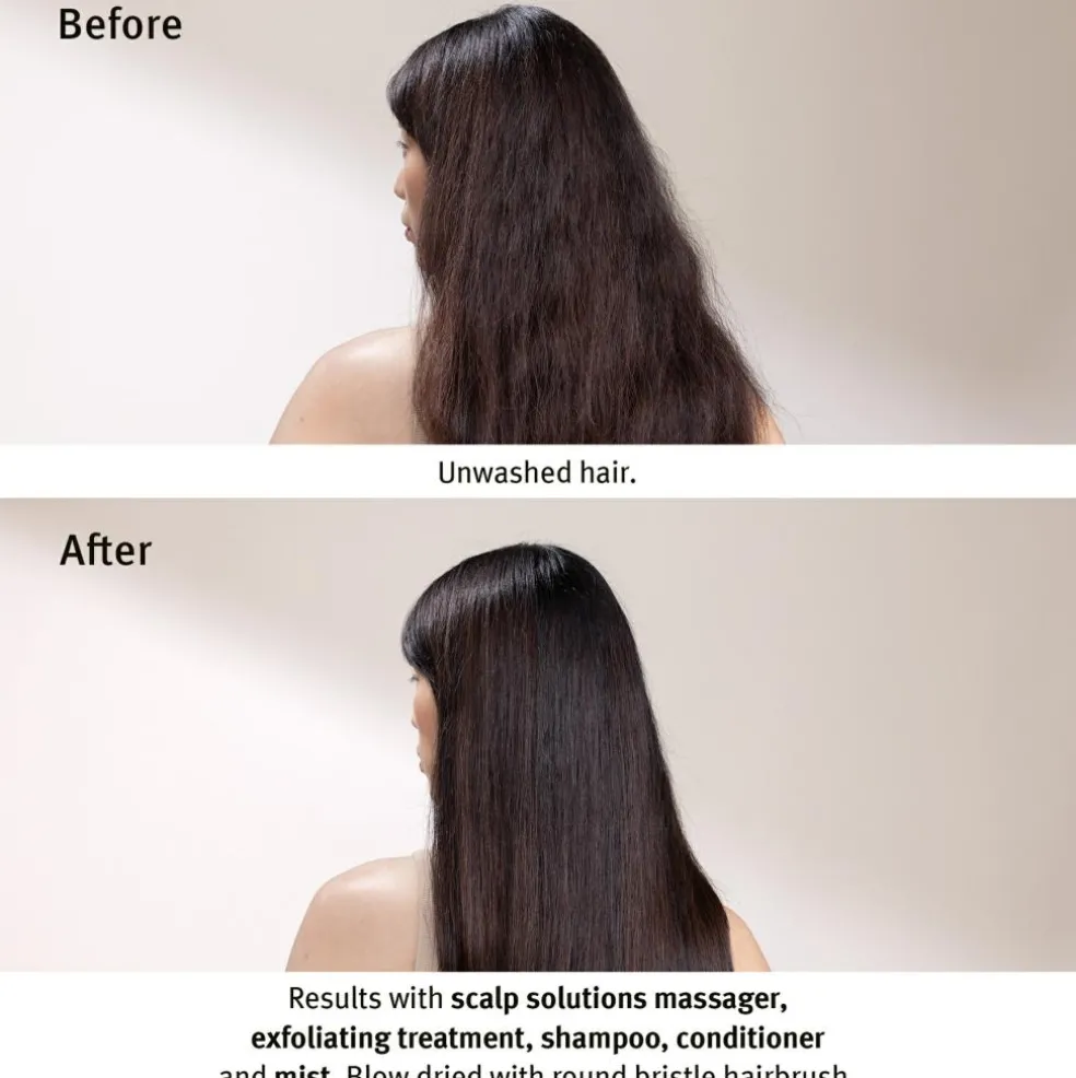 Scalp Solutions Stimulating Scalp Massager