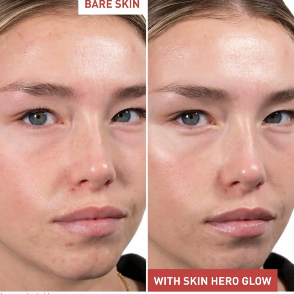 Skin Hero Glow