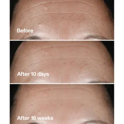 Smart Clinical Repair Wrinkle Correcting Serum