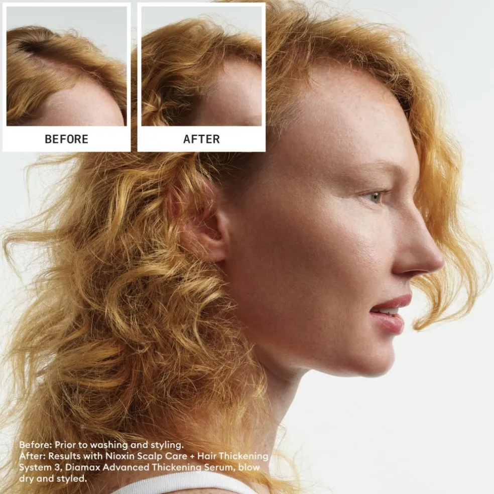 System 4 Loyalty Kit for Colored Thinning Hair