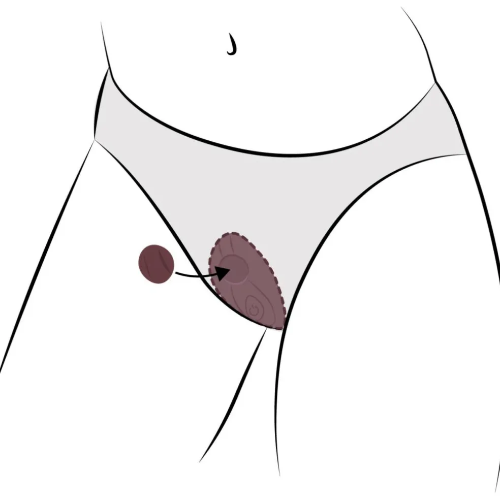 Trusse Vibrator
