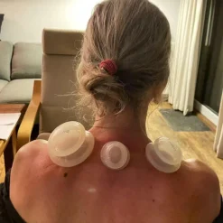 UFO Silicone Cupping Sæt